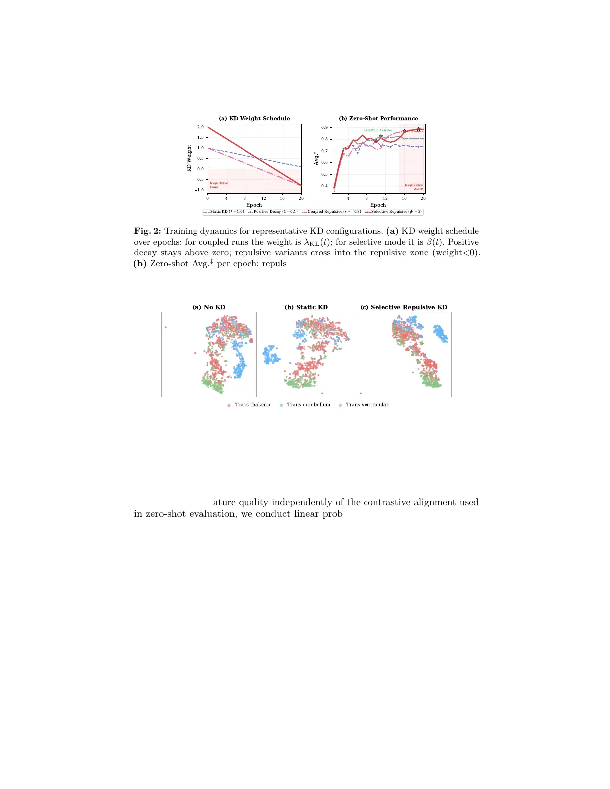 MobileFetalCLIP: Selective Repulsive Knowledge Distillation for Mobile Fetal Ultrasound Analysis