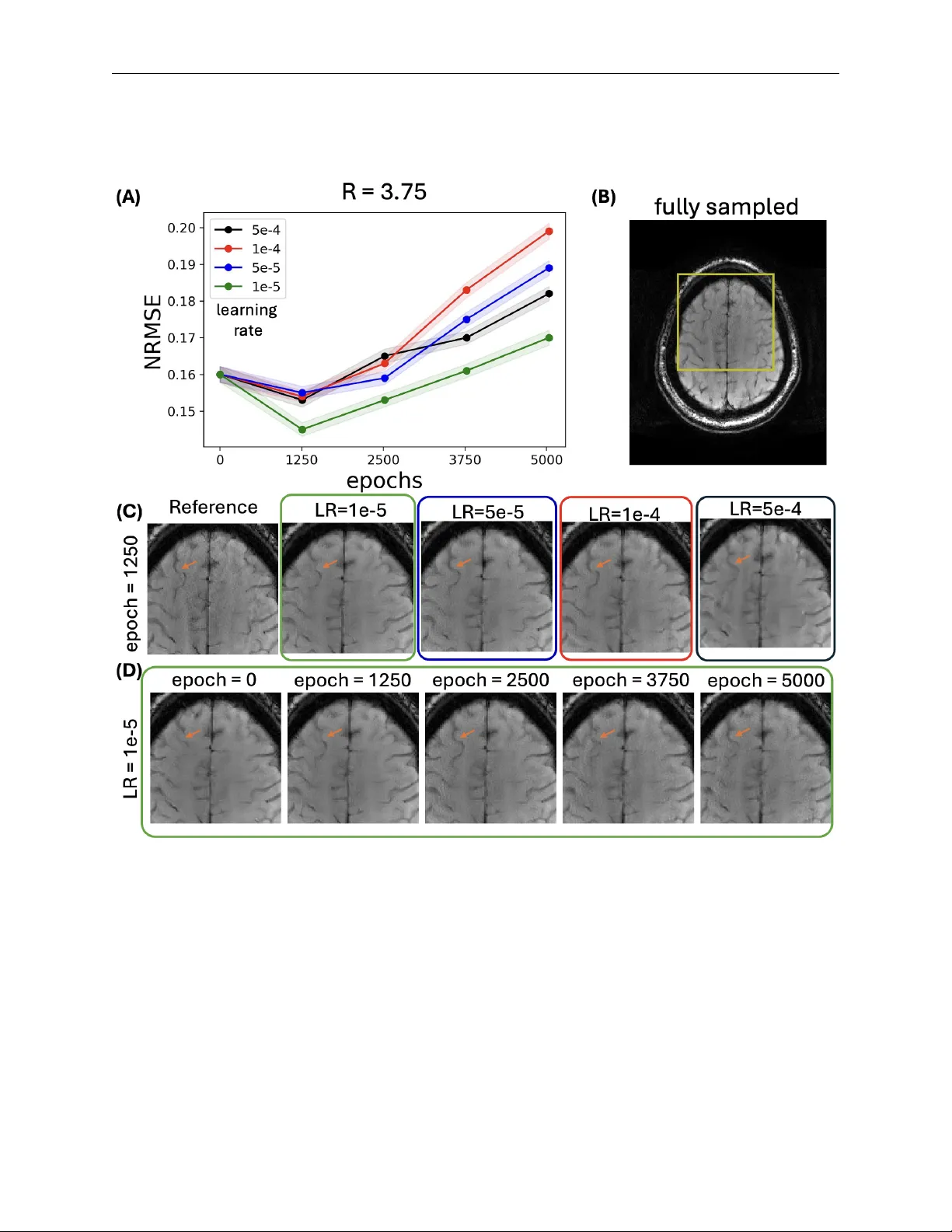 Accelerating Stroke MRI with Diffusion Probabilistic Models through Large-Scale Pre-training and Target-Specific Fine-Tuning