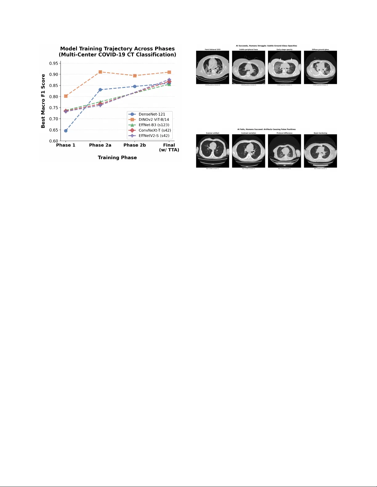 A Heterogeneous Ensemble for Multi-Center COVID-19 Classification from Chest CT Scans