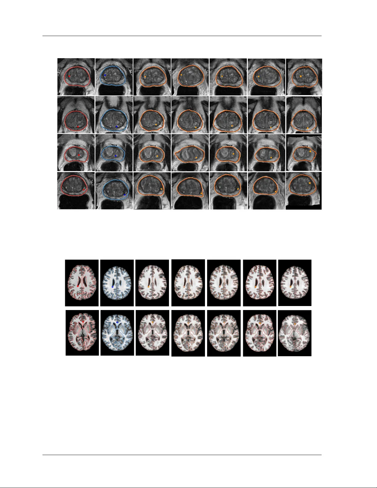 On the Degrees of Freedom of Gridded Control Points in Learning-Based Medical Image Registration