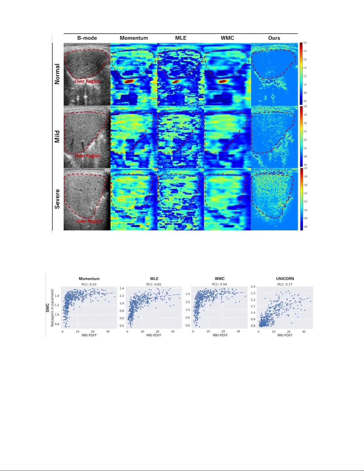 UNICORN: Ultrasound Nakagami Imaging via Score Matching and Adaptation for Assessing Hepatic Steatosis