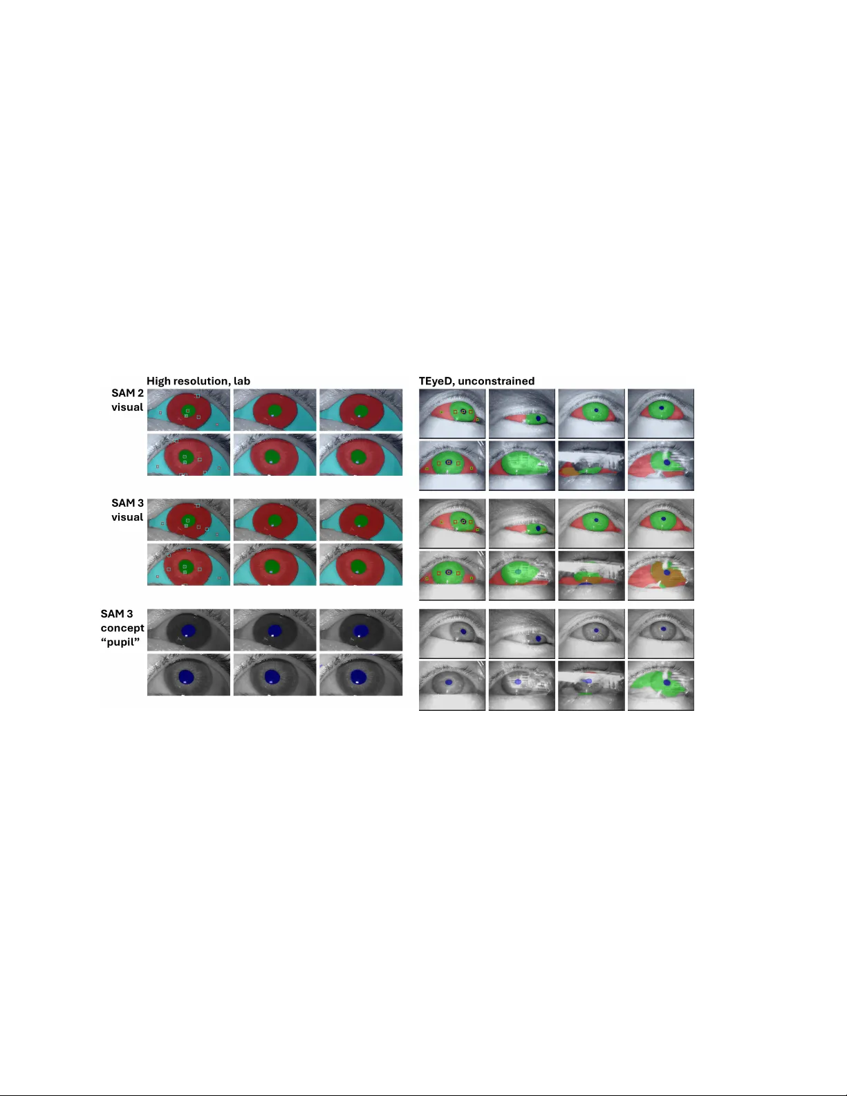 Eye image segmentation using visual and concept prompts with Segment Anything Model 3 (SAM3)