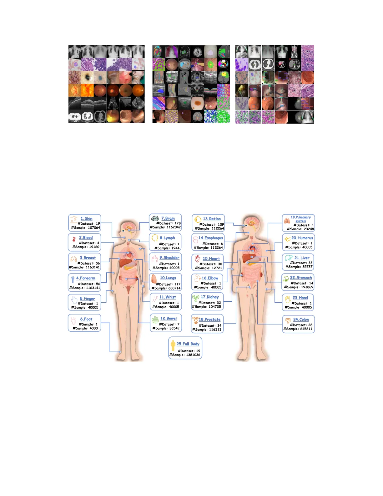 Project Imaging-X: A Survey of 1000+ Open-Access Medical Imaging Datasets for Foundation Model Development
