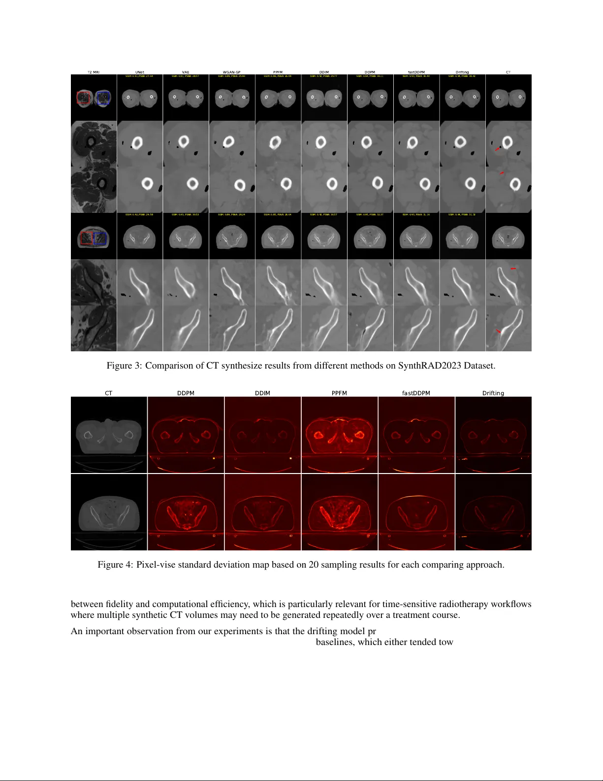 MRI-to-CT synthesis using drifting models