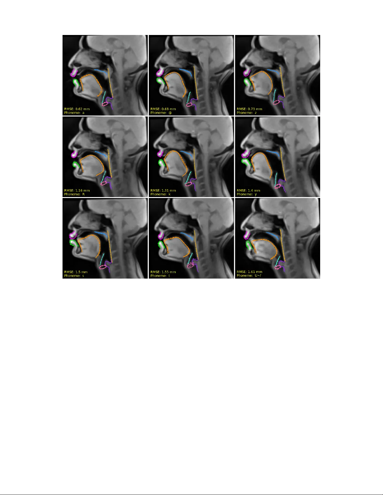 Acoustic-to-articulatory Inversion of the Complete Vocal Tract from RT-MRI with Various Audio Embeddings and Dataset Sizes